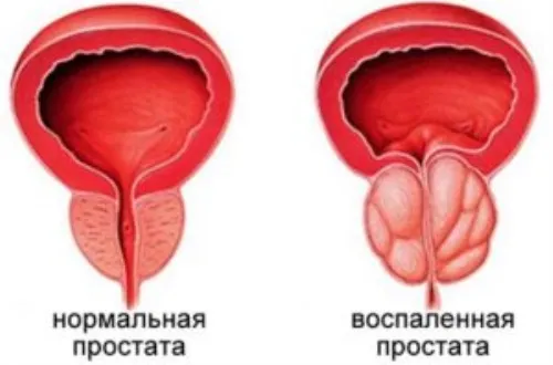 Predstonorm recenzii 2025 • preț • România • cumpără • compoziție.